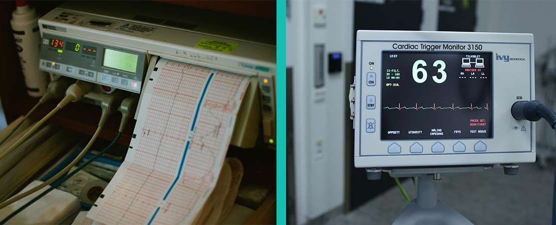 ECG Service in Delhi